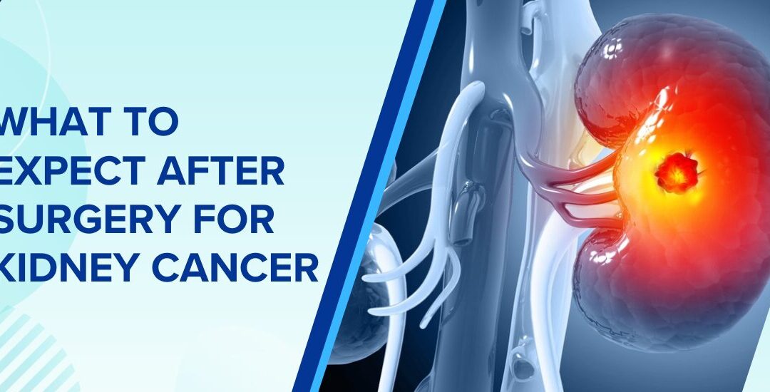 What to Expect After Surgery for Kidney Cancer