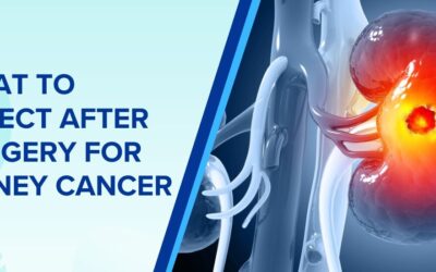 What to Expect After Surgery for Kidney Cancer