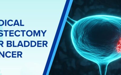 Radical Cystectomy for Bladder Cancer