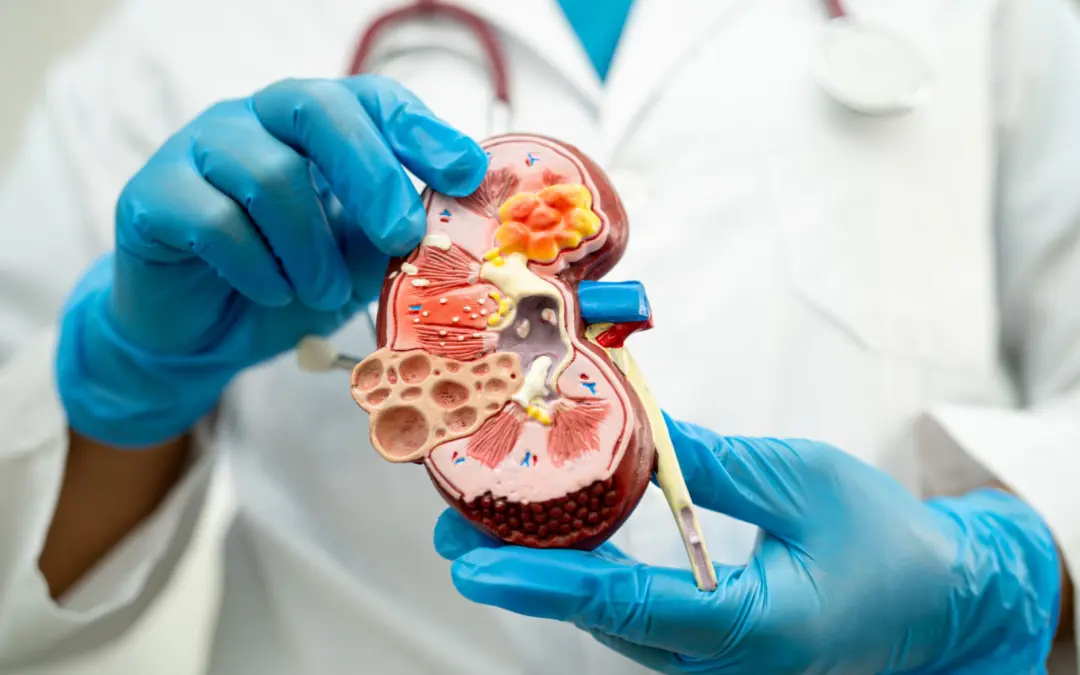What Size of Kidney Stone Requires Surgery