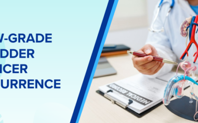 Low-Grade Bladder Cancer Recurrence