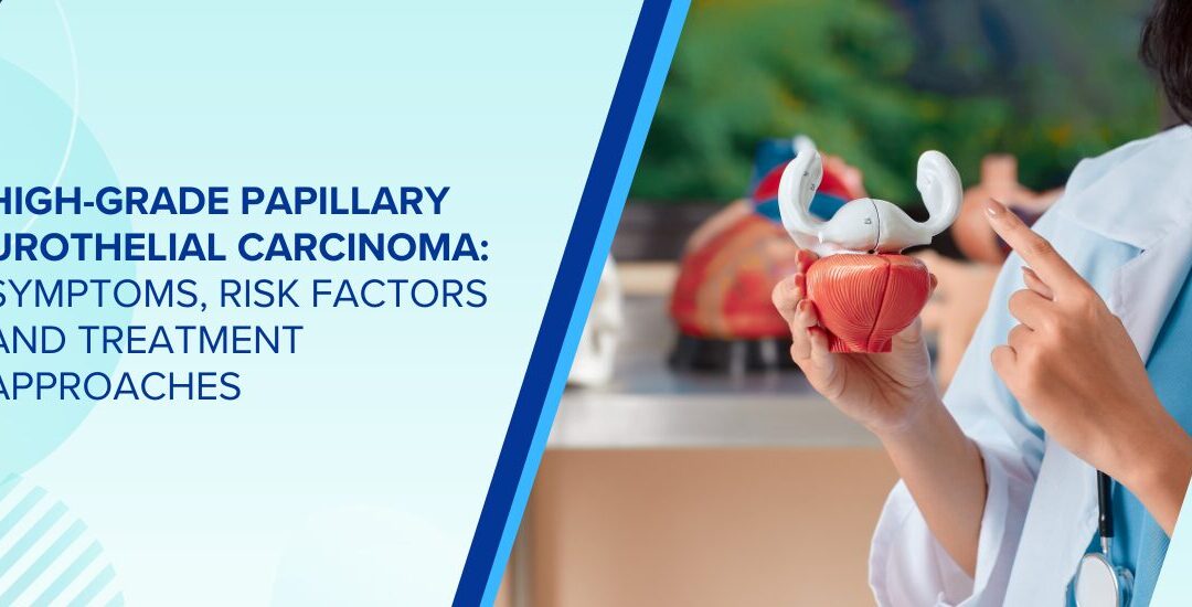 High-Grade Papillary Urothelial Carcinoma: Symptoms, Risk Factors and Treatment Approaches