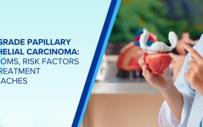 High-Grade Papillary Urothelial Carcinoma: Symptoms, Risk Factors and Treatment Approaches