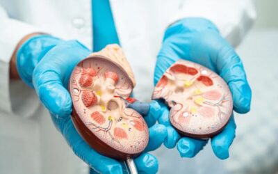 Can Kidney Stones Affect Bowel Movements? Understanding the Connection