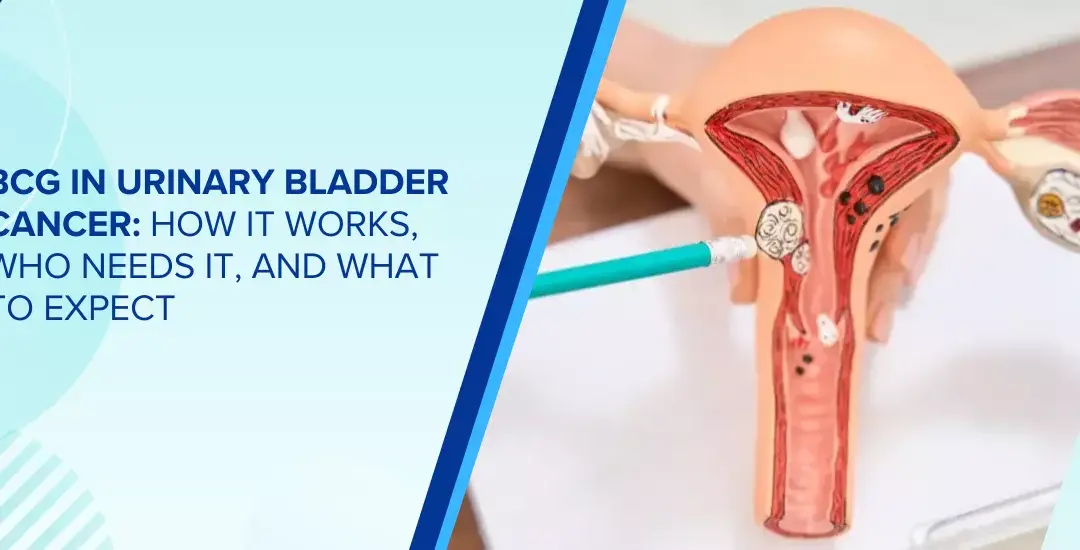 Graphic for article about BCG in urinary bladder cancer: title and illustration of a uterus with a medical instrument, explaining how it works and what to expect