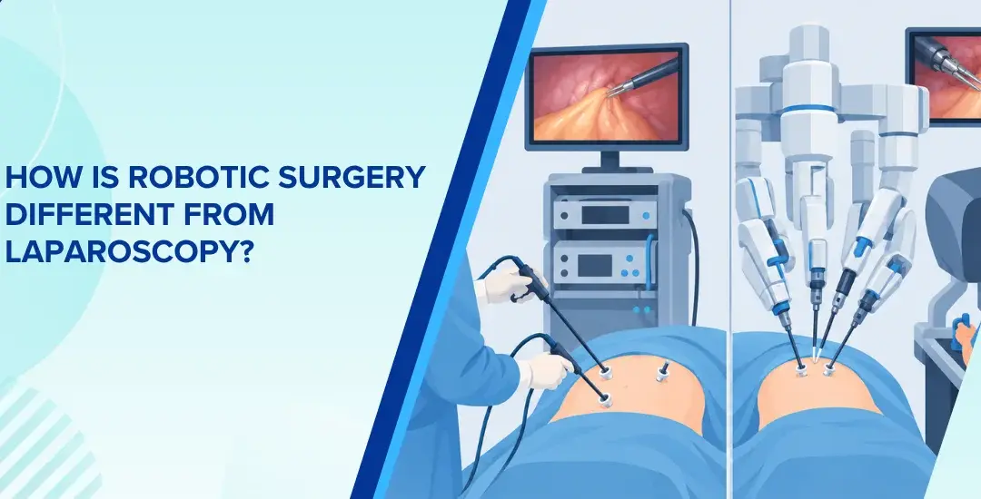 How Is Robotic Surgery Different From Laparoscopy